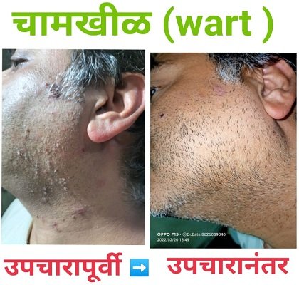 Skin Diseases